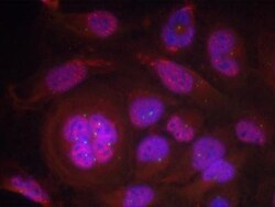 RelA/NFkB p65, p Ser276 Antibody, Novus Biologicals:Antibodies:Primary